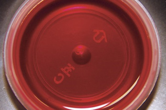 PDMS